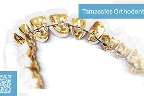 Standard post published to Tamassios Orthodontics - Orthodontist Nicosia, Cyprus at March 02, 2023..