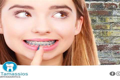 Standard post published to Tamassios Orthodontics - Orthodontist Nicosia, Cyprus at April 08, 2023..