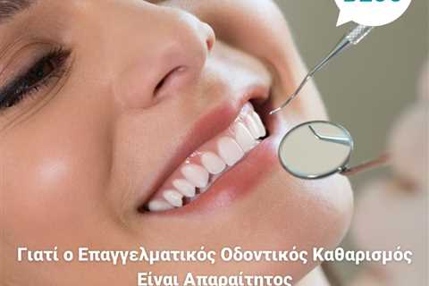 Standard post published to Smalto Dental Clinic at April 23, 2023 10:00