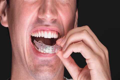 Relieving Discomfort from Invisalign Clear Braces with Dental Wax