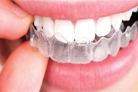 Brushing and Flossing with Invisalign Clear Braces: A Guide