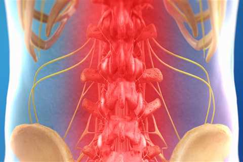 How long does it take for nerves to heal after spinal decompression?