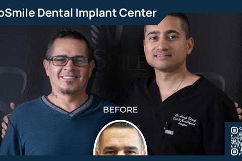 Standard post published to ProSmile Dental Implant Center at May 04, 2023 16:01