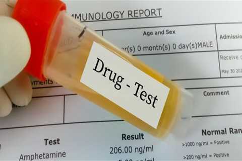 Will Hemp Extract Show Up on a Drug Test?