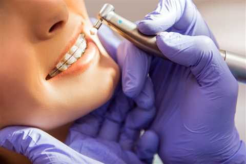 The Role of Orthodontics in Overall Dental Health | Smilebliss