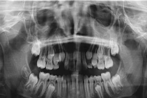 Where are dental x-rays developed?