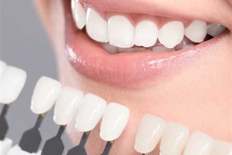 Standard post published to Smalto Dental Clinic at June 04, 2023 10:00