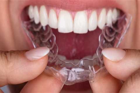 A Clear Choice For Straighter Teeth: Invisalign Clear Braces In Austin