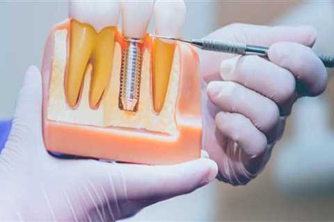 When are dental implants medically necessary?