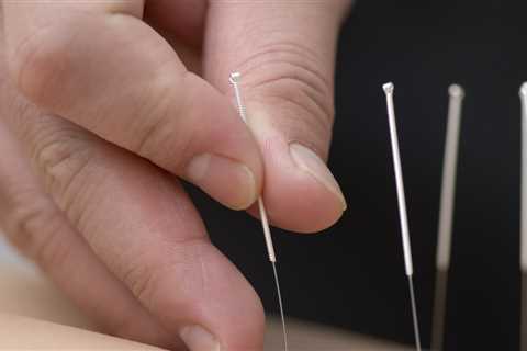 Abdominal Acupuncture Training
