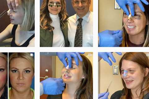 The Seattle Rhinoplasty Center