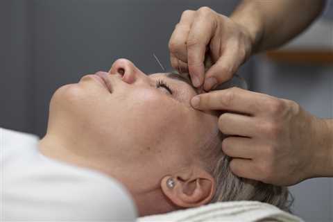 Yamamoto Scalp Acupuncture Training