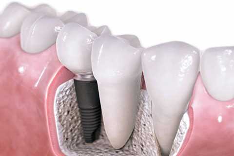 Standard post published to Symeou Dental Center at July 15, 2023 10:00