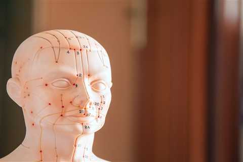 How To Get Trained In Acupuncture?