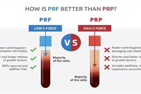 Prp Vs Prf - Vents Magazine