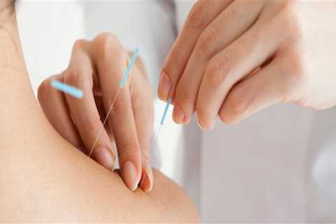 What Health Problems Can Acupuncture Solve?