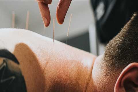 Unlock the Benefits of Acupuncture: 3 Reasons to Try It