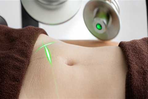 Las Vegas Laser Liposuction: Lose Weight Fast Easily And Safely With The Best Technology