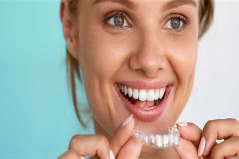 How Do You Use SureSmile Aligners