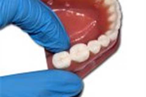 Dental arches