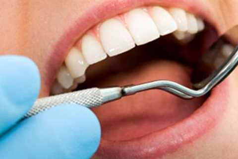 What are Early Signs of Dental Trouble -