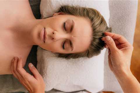 HOW TO USE ACUPUNCTURE FOR INSOMNIA RELIEF
