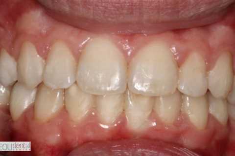 Standard post published to Symeou Dental Center at October 14, 2023 09:00