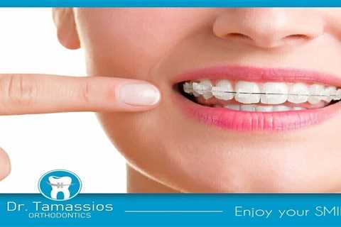 Standard post published to Tamassios Orthodontics - Orthodontist Nicosia, Cyprus at October 23,..