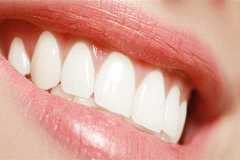 What is an example of cosmetic dentistry?
