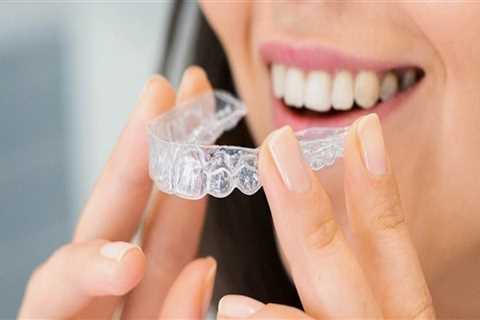 A Smile Makeover With Invisalign In London: What To Expect From Your Invisalign Dentist