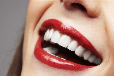 Nature's Smile Reviews: Discover the Natural Solution to Gum Disease - Bad Breath Solution..
