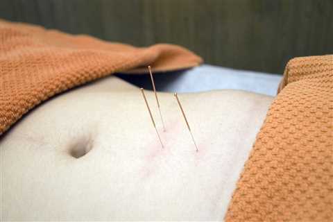 THE ROLE OF ACUPUNCTURE IN TREATING ANXIETY AND DEPRESSION IN ADOLESCENTS WITH INFLAMMATORY BOWEL..