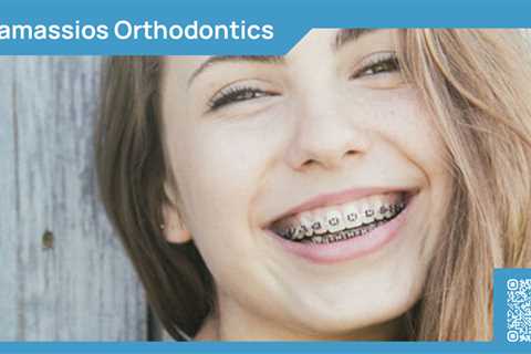 Standard post published to Tamassios Orthodontics - Orthodontist Nicosia, Cyprus at November 27,..