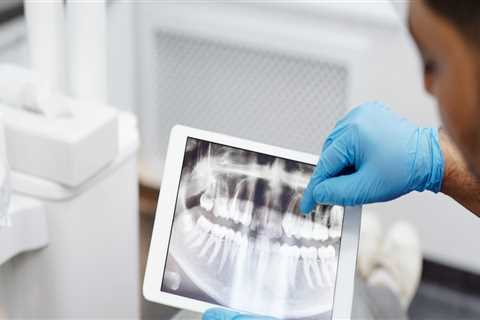 Unveiling The Hidden: Why Dental X-Rays Are Vital For Successful Dental Implants In Taylor, Texas