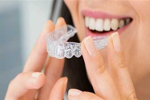 The Invisible Investment: Evaluating The Price Of Invisalign In Hillsboro