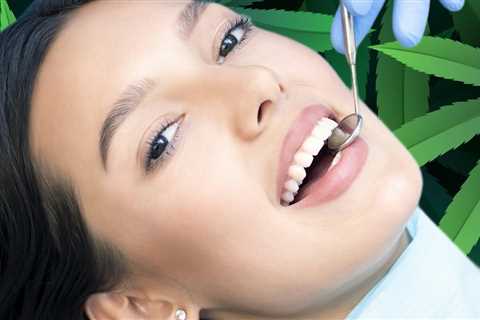 CBD Taken Orally Fights Cavities and Gum Disease? - New Studies Show CBD Helps Dental Health