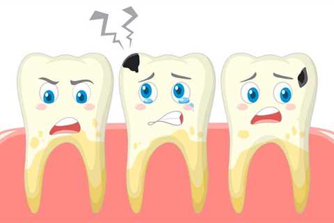 Шүд цайруулах эмчилгээ