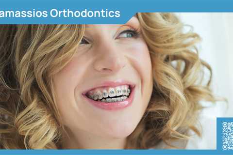 Standard post published to Tamassios Orthodontics - Orthodontist Nicosia, Cyprus at January 14,..