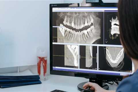 Seeing Beyond The Surface: The Crucial Role Of Dental X-Rays In Helotes, TX
