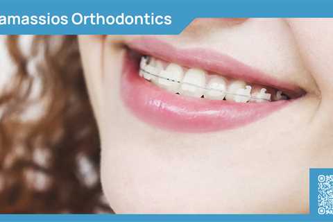 Standard post published to Tamassios Orthodontics - Orthodontist Nicosia, Cyprus at February 02,..