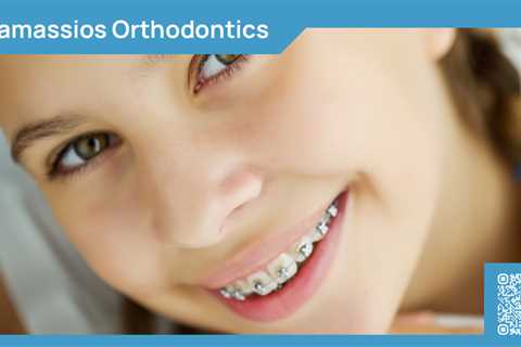 Standard post published to Tamassios Orthodontics - Orthodontist Nicosia, Cyprus at March 03, 2024..
