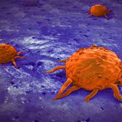 Identifying Characteristics of ‘Zombie’ Cancer Cells May Help Predict Relapse