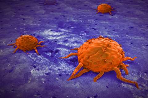 Identifying Characteristics of ‘Zombie’ Cancer Cells May Help Predict Relapse