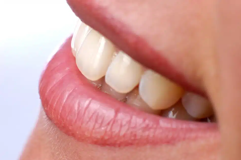 How Professional Teeth Whitening Can Boost Your Confidence and Smile Aesthetics