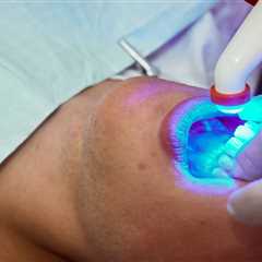 Teeth Whitening Appointment Guide 2024