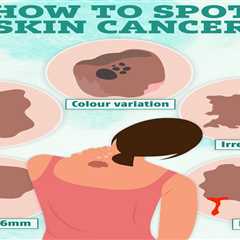 Spot on Your Face: Early Warning Sign of Cancer?