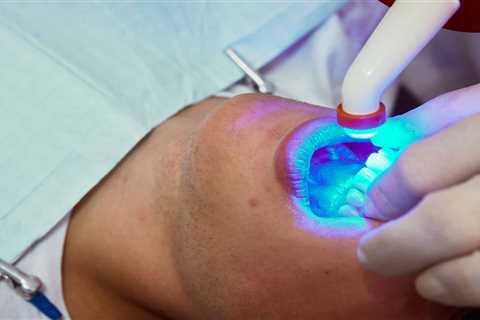 Teeth Whitening Appointment Guide 2024