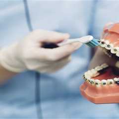 How to Clean Clear Braces That Turned Yellow