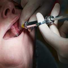 How Basel Residents Maintain Oral Health: Dental Hygiene Tips And Dental Laser Cleaning Insights