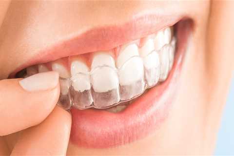 Straighter Smiles With Invisalign Clear Braces From Summerville’s General Dentist